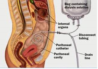 Marengo CIMS Hospital Renal Transplant