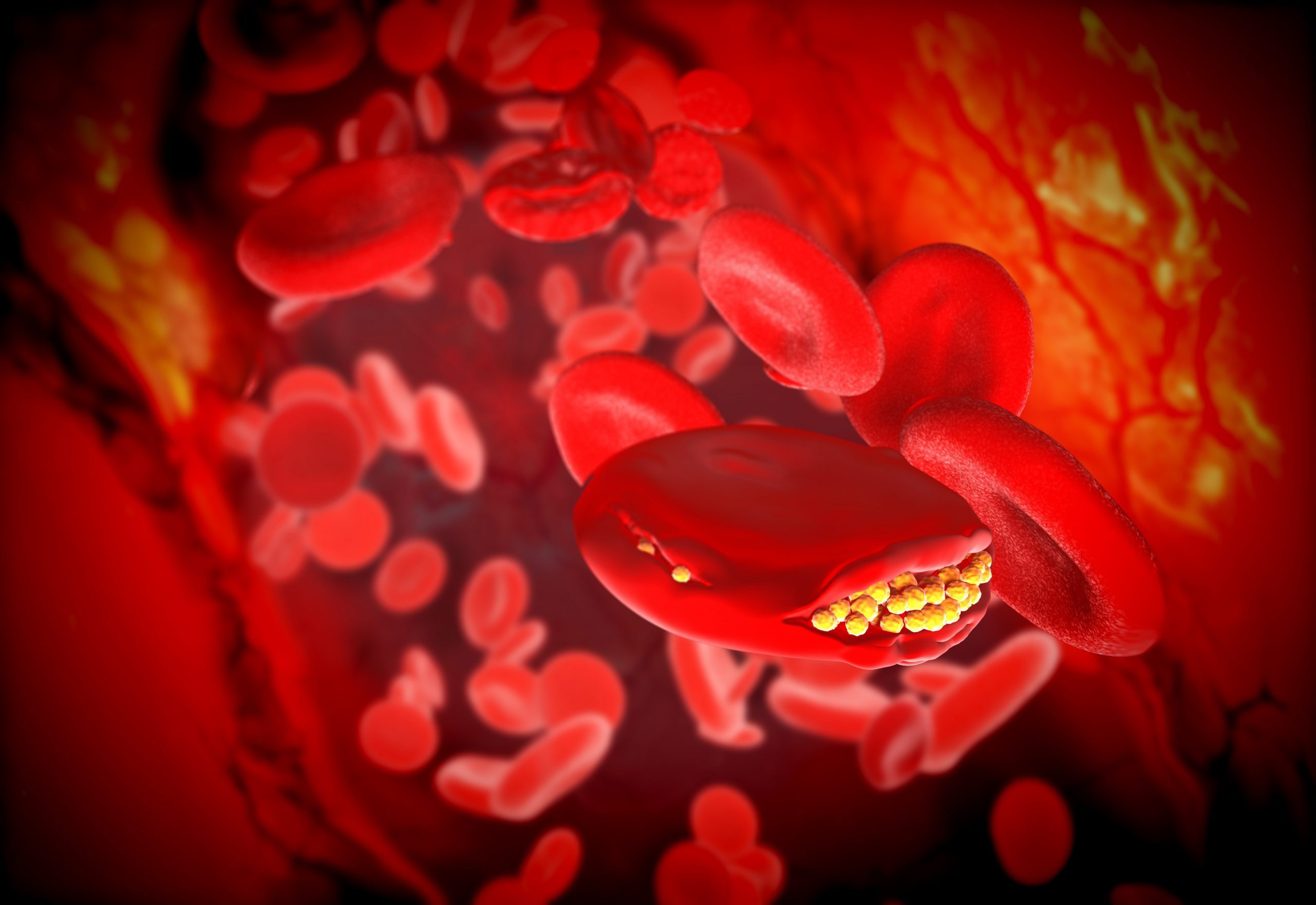 Trigliceridos en sangre