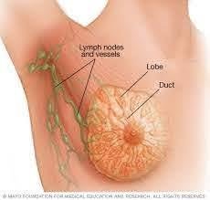 Know about Breast Cancer