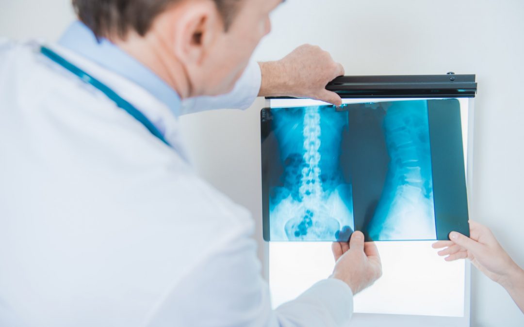Xray Images Doctor Diagnosis