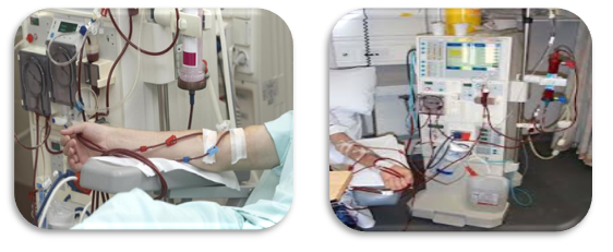 Haemodialysis